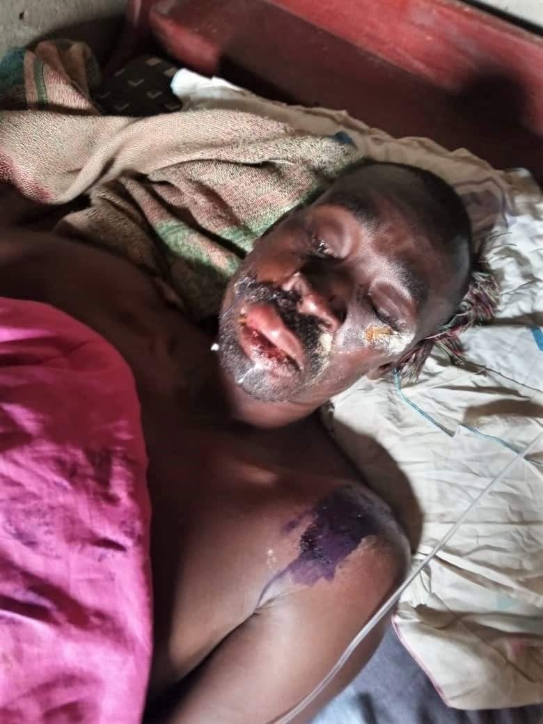 지난 12월22일 염산테러를 당한 무타바지 목사