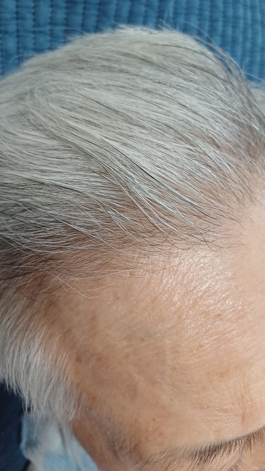 안양호스피스 선교회 입소한 후 신체적 정서적으로 긍정적인 변화가 일어났다.